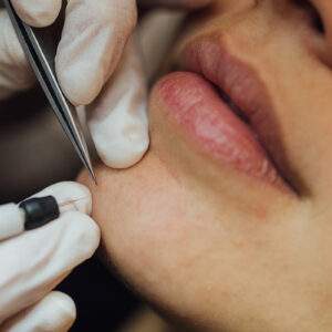 ELECTRÓLISIS (para vello blanco o canas)