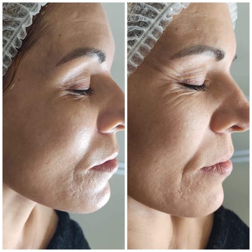 tto iluminador, puesto en rrss como MC de biologuique